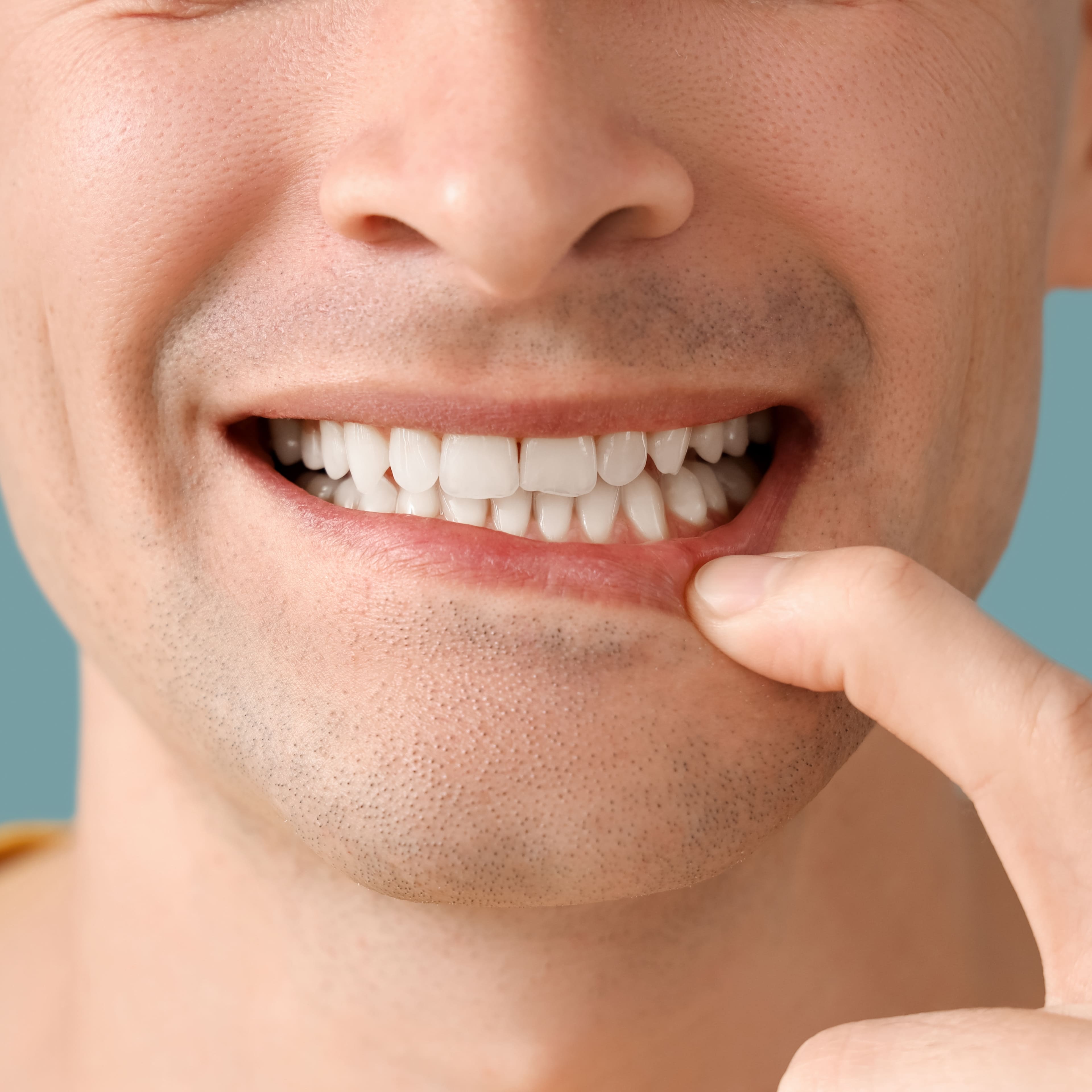 Bonne hygiène dentaire diminution risque AVC